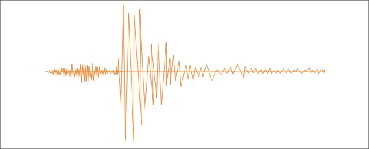复杂环境下的声发射信号去噪及信号分析方法